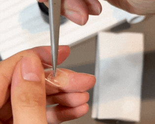 3.PEEL